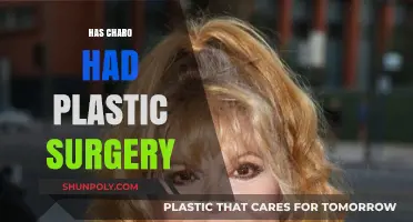 Has Charo Had Plastic Surgery? Unveiling the Truth Behind Her Look