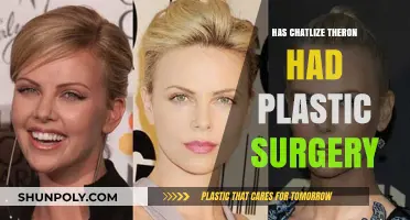 Charlize Theron's Transformation: Plastic Surgery Rumors Explored