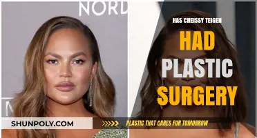 Chrissy Teigen's Transformation: Plastic Surgery Rumors and Reality Revealed