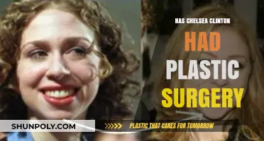 Chelsea Clinton Plastic Surgery: Fact-Checking the Rumors and Speculations