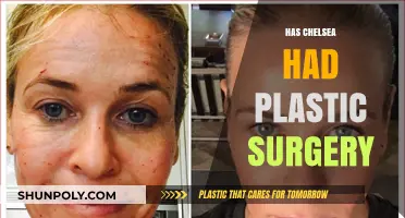 Chelsea's Transformation: Unveiling the Truth About Plastic Surgery Speculations