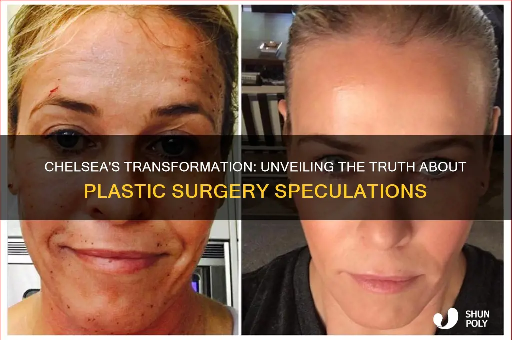 has chelsea had plastic surgery