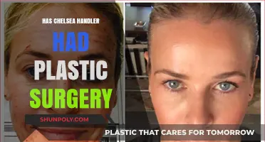 Chelsea Handler's Transformation: Plastic Surgery Rumors and Reality Explored
