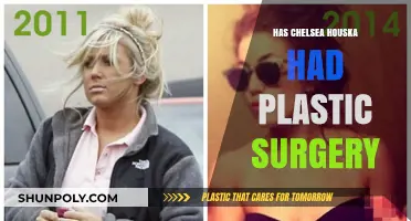 Chelsea Houska's Transformation: Plastic Surgery Rumors Explored