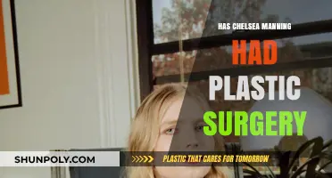 Chelsea Manning's Transformation: Plastic Surgery Speculations and Facts Revealed