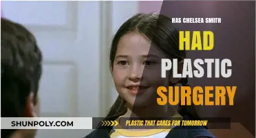 Chelsea Smith's Transformation: Plastic Surgery Rumors Explored and Debunked