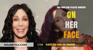 Cher's Ageless Beauty: Unveiling the Truth About Her Facial Transformation