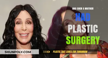 Cher's Mother and Plastic Surgery: Unveiling the Truth Behind the Rumors