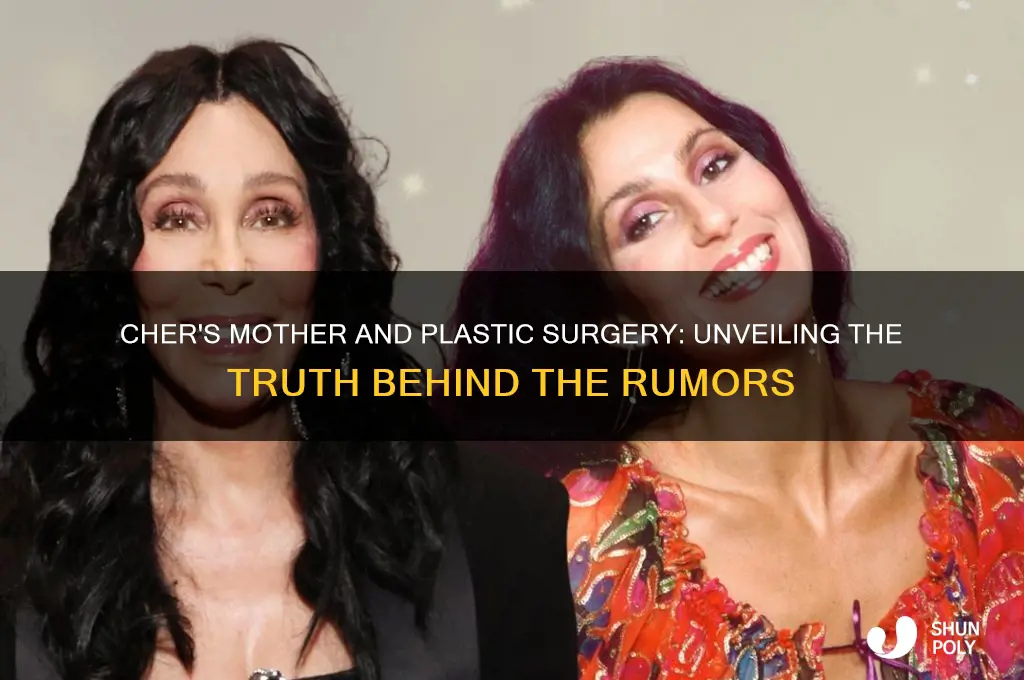 has cher s mother had plastic surgery
