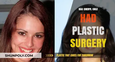 Cheryl Cole's Transformation: Plastic Surgery Rumors and Reality Revealed