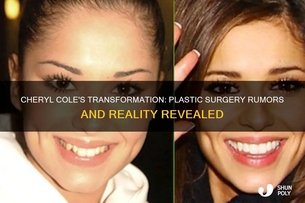 has cheryl cole had plastic surgery