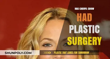 Cheryl Crow's Transformation: Plastic Surgery Rumors and Speculations