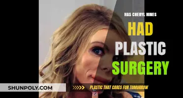 Cheryl Hines Plastic Surgery: Fact-Checking the Rumors and Speculations