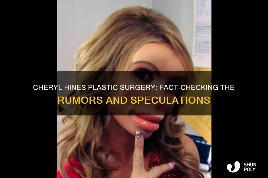 has cheryl hines had plastic surgery