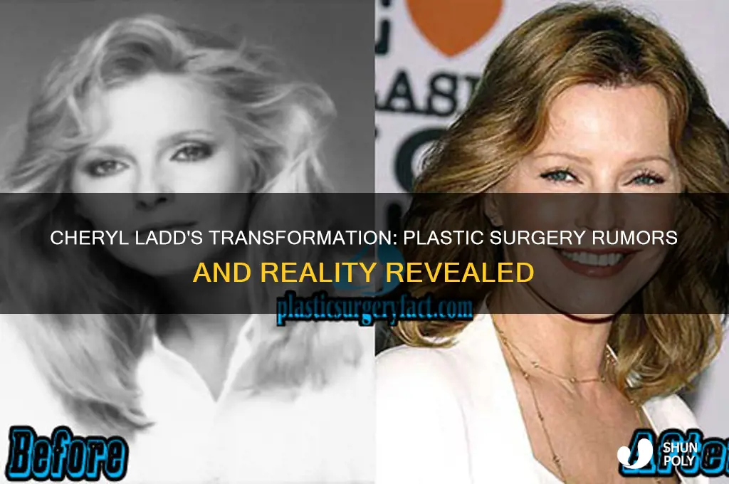 has cheryl ladd had plastic surgery
