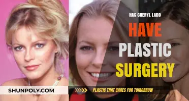 Cheryl Ladd's Transformation: Plastic Surgery Rumors and Speculations