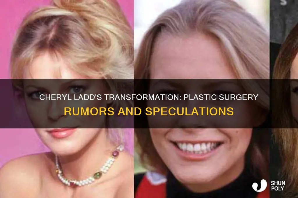 has cheryl ladd have plastic surgery