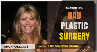 Cheryl Tiegs Plastic Surgery: Fact-Checking the Rumors and Speculations
