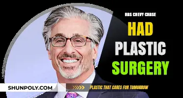 Chevy Chase's Changing Looks: Plastic Surgery Speculations Explored