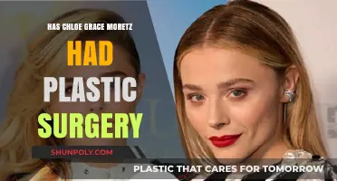 Chloe Grace Moretz Plastic Surgery: Fact-Checking the Rumors and Speculations