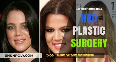 Chloe Kardashian's Transformation: Plastic Surgery Speculations and Truths