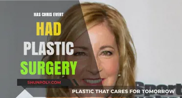 Chris Evert Plastic Surgery: Fact-Checking the Tennis Legend's Appearance