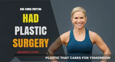 Chris Freytag Plastic Surgery: Fact-Checking the Rumors and Speculations