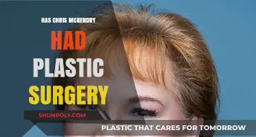 Chris McKendry's Appearance: Plastic Surgery Speculations and Facts