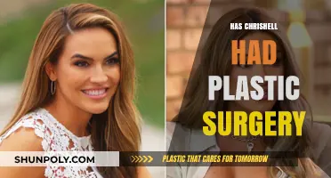 Chrishell's Transformation: Plastic Surgery Rumors and Reality Revealed