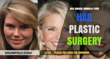 Chrisie Brinkley's Beauty Secrets: Plastic Surgery or Natural Glow?
