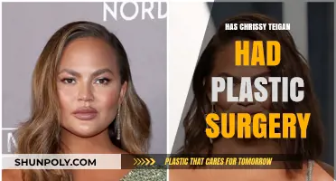 Chrissy Teigen's Transformation: Plastic Surgery Speculations and Truths Revealed