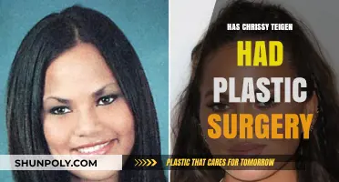 Chrissy Teigen's Transformation: Plastic Surgery Speculations and Truths Revealed
