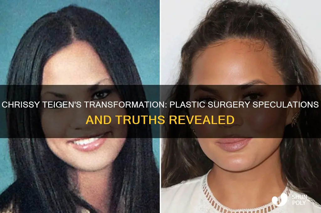 has chrissy teigen had plastic surgery