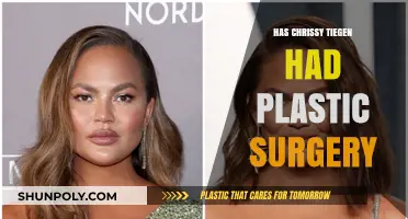 Chrissy Teigen's Transformation: Plastic Surgery Speculations and Truths Revealed