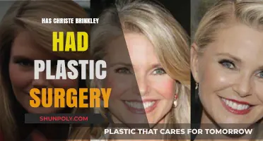 Christie Brinkley's Ageless Beauty: Plastic Surgery Speculations Explored