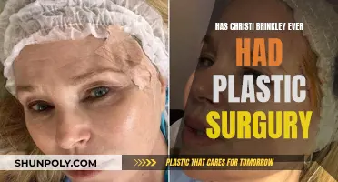 Christie Brinkley's Plastic Surgery: Fact or Fiction?