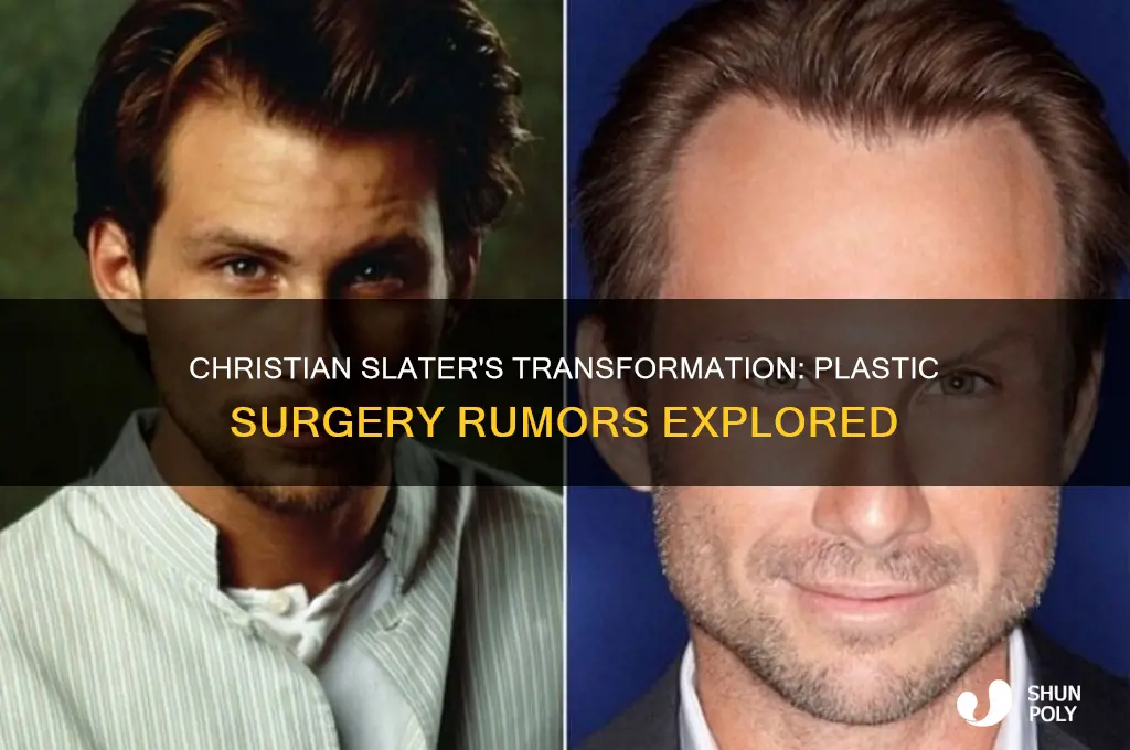 has christian slater had plastic surgery