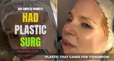 Christie Brinkley's Plastic Surgery: Natural or Enhanced?