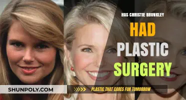Christie Brinkley's Ageless Beauty: Plastic Surgery Speculations Explored