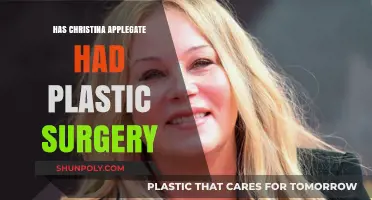 Christina Applegate's Transformation: Plastic Surgery Rumors Explored
