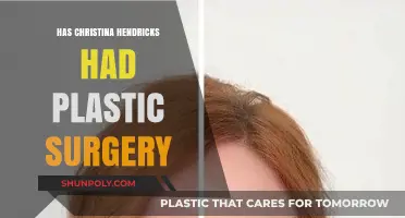 Christina Hendricks Plastic Surgery: Fact-Checking the Rumors and Speculations