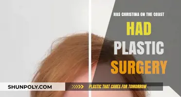 Christina on the Coast: Plastic Surgery Speculations and Transformation