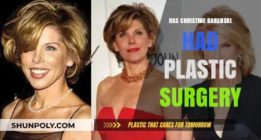 Christine Baranski Plastic Surgery: Fact-Checking the Rumors and Speculations