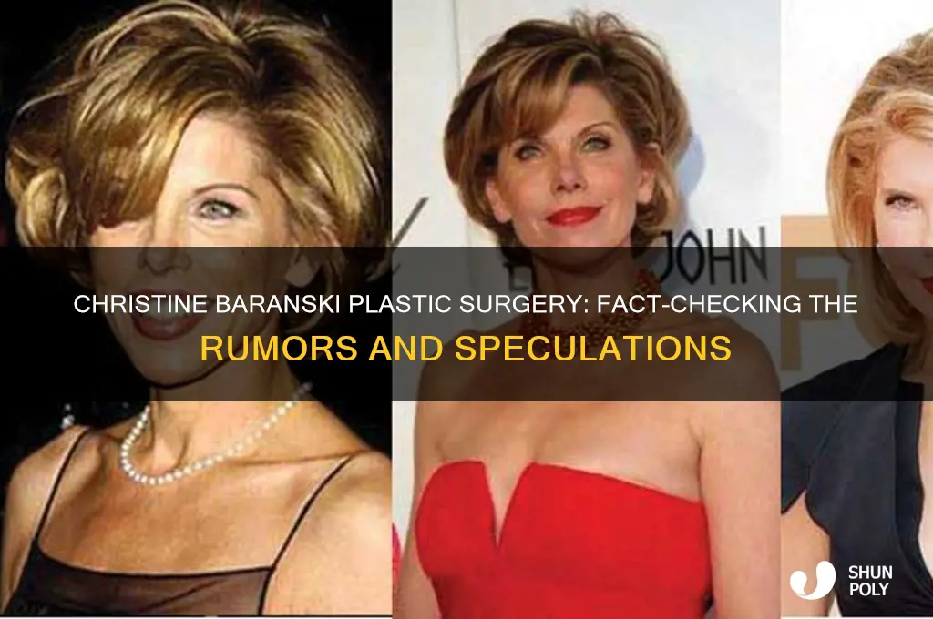 has christine baranski had plastic surgery