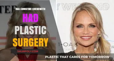 Christine Chenoweth's Transformation: Plastic Surgery Speculations and Truths