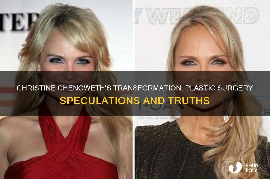 has christine chenoweth had plastic surgery
