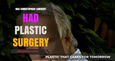 Christopher Lambert's Appearance: Plastic Surgery Rumors Explored and Debated