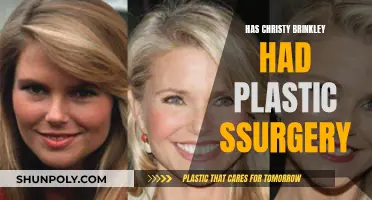 Christie Brinkley's Plastic Surgery: Fact or Fiction?
