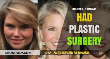 Christy Brinkley's Ageless Beauty: Plastic Surgery Rumors Explored