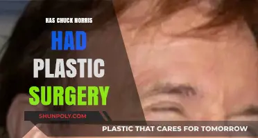 Chuck Norris Plastic Surgery: Fact or Fiction? Unveiling the Truth